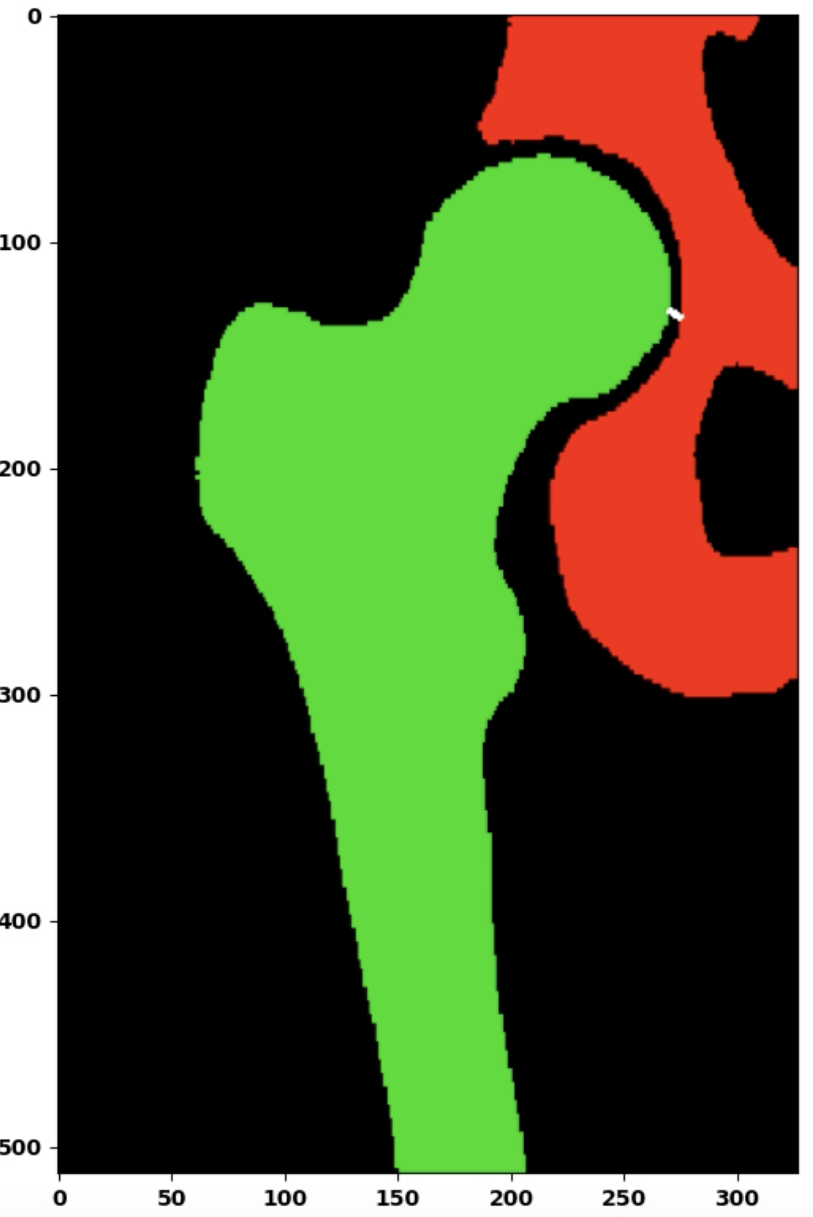 image of product نرم افزار های مبتنی بر هوش مصنوعی برای تشخیص آسیب دیدگی استخوان لگن،سرویس تشخیص چروک های پوستی